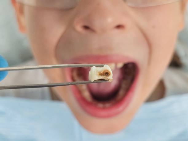 Best Emergency Pediatric Dentist  in Lakemont, PA